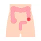 Abdomen Cancer Surgeries